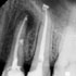 My Teeth Hurt